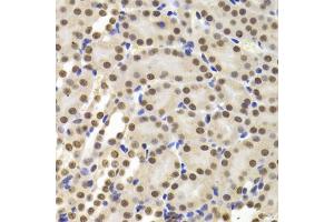 Immunohistochemistry of paraffin-embedded mouse kidney using PPP1R8 Antibody (ABIN5974046) at dilution of 1/100 (40x lens). (PPP1R8 Antikörper)