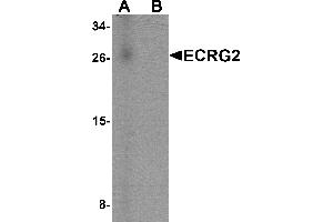 Western blot analysis of ECRG2 in human lung tissue lysate with ECRG2 antibody at 1 µg/mL in (A) the absence and (B) the presence of blocking peptide. (SPINK7/ECRG2 Antikörper  (C-Term))
