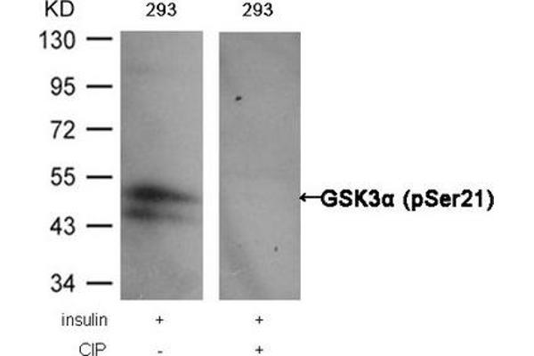 GSK3 alpha Antikörper  (pSer21)