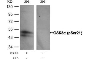 Western blot analysis of extracts from 293 cells, treated with insulin or calf intestinal phosphatase (CIP), using GSK3α (Phospho-Ser21) Antibody.