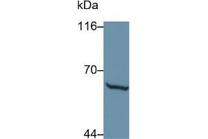 Detection of MMP1 in Caprine Skin lysate using Polyclonal Antibody to Matrix Metalloproteinase 1 (MMP1)