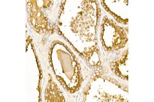 Immunohistochemistry (IHC) image for anti-Acid Phosphatase, Prostate (ACPP) (AA 40-300) antibody (ABIN3022672)