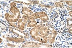 Immunohistochemical staining (Formalin-fixed paraffin-embedded sections) of human kidney with GMPPB polyclonal antibody  at 4-8 ug/mL working concentration. (GMPPB Antikörper  (C-Term))