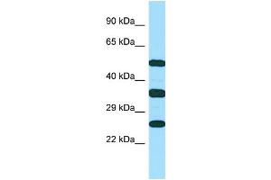 WB Suggested Anti-RAET1E Antibody Titration: 1. (Retinoic Acid Early Transcript 1E (RAET1E) (C-Term) Antikörper)