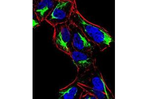 Immunofluorescence (IF) image for anti-Activating Transcription Factor 3 (ATF3) (AA 1-181) antibody (ABIN5542272)