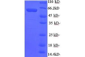 SDS-PAGE (SDS) image for Synapsin I (SYN1) (AA 113-420), (partial) protein (GST tag) (ABIN5710446) (SYN1 Protein (AA 113-420, partial) (GST tag))