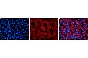 Immunohistochemistry (IHC) image for anti-Mitogen-Activated Protein Kinase Kinase 3 (MAP2K3) (N-Term) antibody (ABIN502211) (MAP2K3 Antikörper  (N-Term))