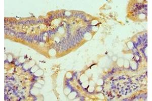 Immunohistochemistry of paraffin-embedded human small intestine tissue using ABIN7149059 at dilution of 1:100 (KAT14 Antikörper  (AA 523-782))