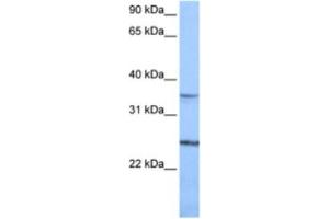Western Blotting (WB) image for anti-Phosphatidylinositol Glycan F (PIGF) antibody (ABIN2462126) (PIGF Antikörper)