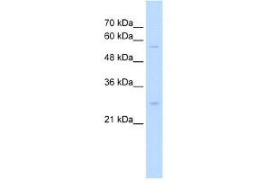 SOCS1 antibody - N-terminal region  validated by WB using Jurkat cell lysate at 0. (SOCS1 Antikörper  (N-Term))