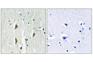Immunohistochemistry (IHC) image for anti-P21-Activated Kinases 1/2/3 (PAK1/2/3) (Thr402), (Thr421), (Thr423) antibody (ABIN1847964)