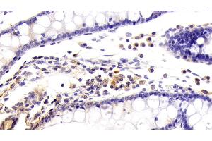 Detection of KMO in Human Colon Tissue using Polyclonal Antibody to Kynurenine-3-Monooxygenase (KMO) (KMO Antikörper  (AA 1-374))