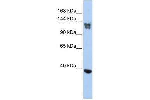 WB Suggested Anti-SMARCA1 Antibody Titration:  0. (SMARCA1 Antikörper  (N-Term))