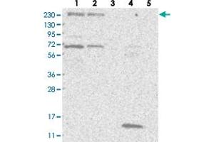 Western blot analysis of Lane 1: RT-4, Lane 2: U-251 MG, Lane 3: Human Plasma, Lane 4: Liver, Lane 5: Tonsil with KIAA1244 polyclonal antibody . (ARFGEF3/KIAA1244 Antikörper)