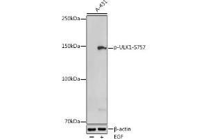 Western blot analysis of extracts of A-431 cells, using Phospho-ULK1-S757 antibody (ABIN6135334, ABIN6136284, ABIN6136285 and ABIN6225646) at 1:500 dilution. (ULK1 Antikörper  (pSer757))