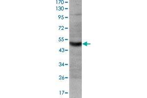 Western blot analysis using TNFRSF8 monoclonal antibody, clone 3B10  against HeLa cell lysate. (TNFRSF8 Antikörper)
