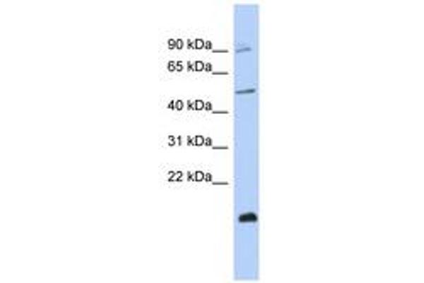 ZNF645 Antikörper  (C-Term)