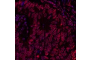 Immunofluorescence (IF) image for anti-Bromodomain Containing 3 (BRD3) (AA 676-726) antibody (ABIN7454022) (Rekombinanter BRD3 Antikörper  (AA 676-726))