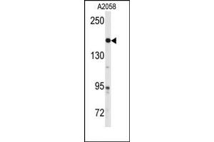 Image no. 1 for anti-ABL2 (ABL2) (Center) antibody (ABIN358073) (ABL2 Antikörper  (Center))