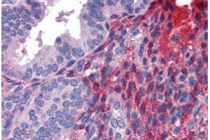 Human Uterus (formalin-fixed, paraffin-embedded) stained with DCST1 antibody ABIN462239 followed by biotinylated goat anti-rabbit IgG secondary antibody ABIN481713, alkaline phosphatase-streptavidin and chromogen. (DCST1 Antikörper  (C-Term))