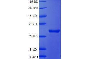 SDS-PAGE (SDS) image for Clusterin (CLU) (AA 23-224) protein (His tag) (ABIN5712447)