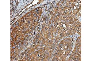 IHC analysis of EEF2 using anti-EEF2 antibody (ABIN7599561).