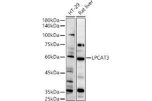 Western blot analysis of extracts of various cell lines, using LPC antibody (ABIN7268337) at 1:500 dilution. (LPCAT3 Antikörper  (AA 160-370))