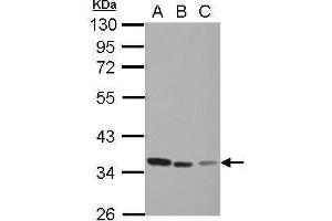 WB Image Sample (30 ug of whole cell lysate) A: Jurkat B: Raji C: THP-1 10% SDS PAGE antibody diluted at 1:1000 (TYMS Antikörper)
