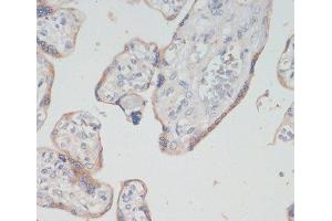 Immunohistochemistry of paraffin-embedded Human placenta using CHAT Polyclonal Antibody at dilution of 1:200 (40x lens). (Choline Acetyltransferase Antikörper)