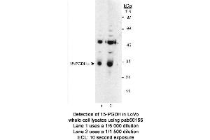 Image no. 1 for anti-Hydroxyprostaglandin Dehydrogenase 15-(NAD) (HPGD) antibody (ABIN363465)