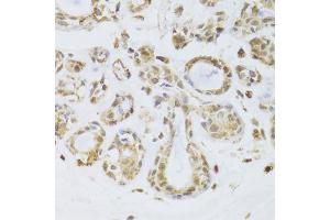 Immunohistochemistry of paraffin-embedded human breast using ILF2 Antibody (ABIN5973487) at dilution of 1/100 (40x lens). (ILF2 Antikörper)