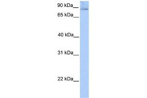 WB Suggested Anti-SLITRK1 Antibody Titration:  0. (SLITRK1 Antikörper  (N-Term))