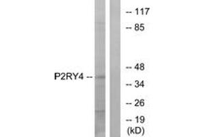 Western Blotting (WB) image for anti-Pyrimidinergic Receptor P2Y, G-Protein Coupled, 4 (P2RY4) (AA 159-208) antibody (ABIN2891067) (P2RY4 Antikörper  (AA 159-208))