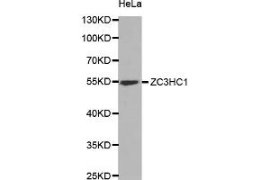 Western blot analysis of extracts of HeLa cells, using ZC3HC1 antibody (ABIN5973745) at 1/1000 dilution. (ZC3HC1 Antikörper)