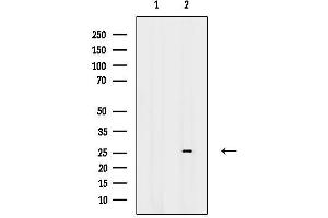 anti-Zinc Finger Protein 230 (ZNF230) antibody