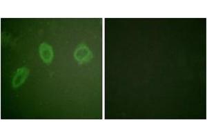 Immunofluorescence analysis of HuvEc cells, using HER2 (Ab-686) Antibody.