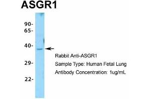 Host:  Rabbit  Target Name:  ASGR1  Sample Type:  Human Fetal Lung  Antibody Dilution:  1. (Asialoglycoprotein Receptor 1 Antikörper  (N-Term))