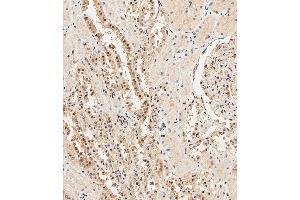 Immunohistochemistry (Paraffin-embedded Sections) (IHC (p)) image for anti-Ubiquitin (Ub) (AA 1-32), (N-Term) antibody (ABIN388039)