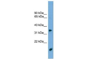 TMPRSS3 antibody used at 1 ug/ml to detect target protein. (TMPRSS3 Antikörper  (N-Term))