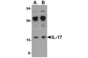 Western blot analysis of IL-17 in A-20 lysate with AP30410PU-N IL-17 antibody at (A) 0. (Interleukin 17a Antikörper  (Center))