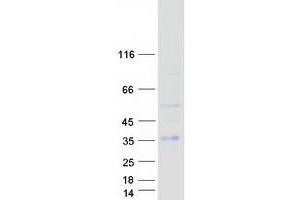 Western Blotting (WB) image for Regulator of G-Protein Signaling 20 (RGS20) (Transcript Variant 2) protein (Myc-DYKDDDDK Tag) (ABIN2730828)