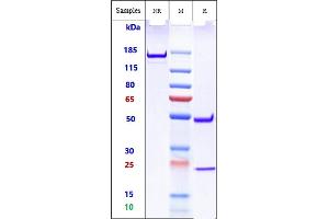 Anti-TREM2 Reference Antibody (Py314) on SDS-PAGE under reducing (R) condition. (Rekombinanter TREM2 Antikörper)