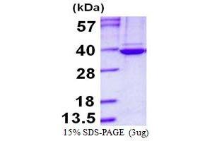 Image no. 1 for Tubulin Folding Cofactor B (TBCB) protein (His tag) (ABIN1098304)