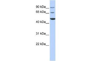 KCND3 antibody used at 1 ug/ml to detect target protein. (KCND3 Antikörper  (Middle Region))