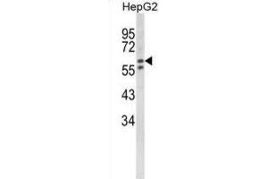 Western Blotting (WB) image for anti-Hexosaminidase A (HEXA) antibody (ABIN3002900) (Hexosaminidase A Antikörper)