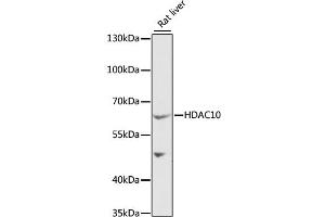 Western blot analysis of extracts of rat liver, using HDAC10 antibody (ABIN1882316) at 1:1000 dilution. (HDAC10 Antikörper)
