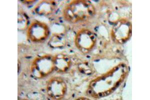 Used in DAB staining on fromalin fixed paraffin-embedded Kidney tissue (ACE2 Antikörper  (AA 93-464))