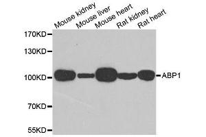 Western blot analysis of extracts of various cell lines, using AOC1 antibody. (DAO Antikörper  (AA 20-300))