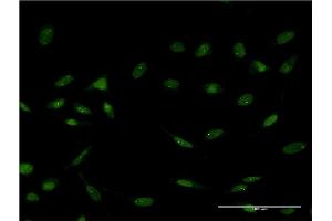 Immunofluorescence of monoclonal antibody to FOXC2 on HeLa cell. (FOXC2 Antikörper  (AA 156-256))