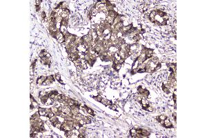 Immunohistochemistry (IHC) image for anti-Glyoxalase I (GLO1) (AA 2-184) antibody (ABIN5692862)